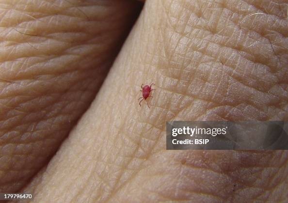 Chigger on hand Chigger on hand