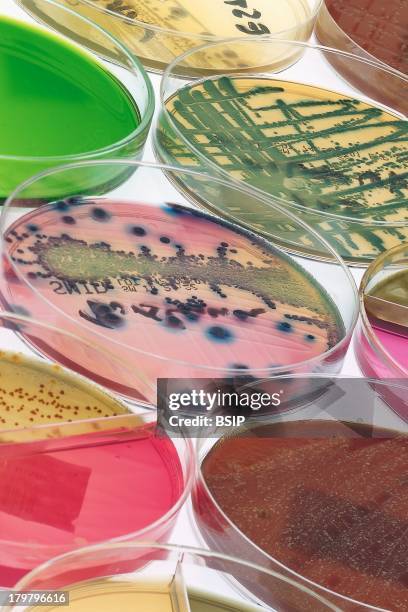 Petri Dish, Citrobacter Freundi, Staphylococcus Epidermis.