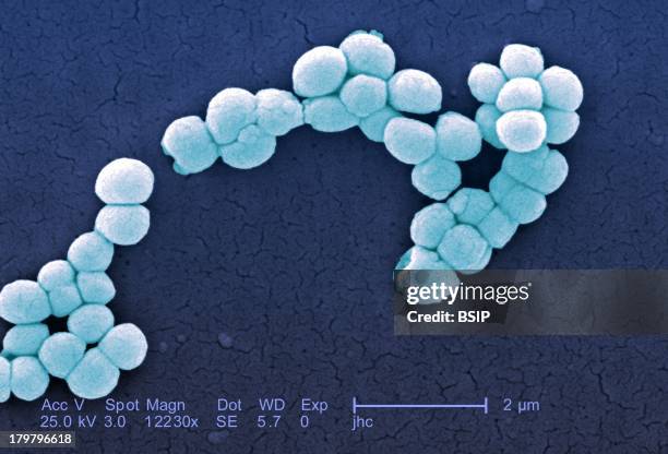 Micrococcus Luteus, Immunocompromised Such Aids Patients, Or Those On Chemotherapy, Need To Be Concerned About These Bacteria, However, These...