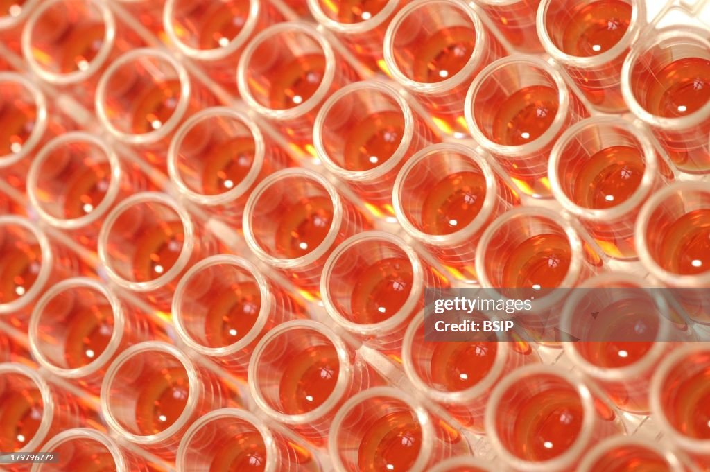 Blood Analysis