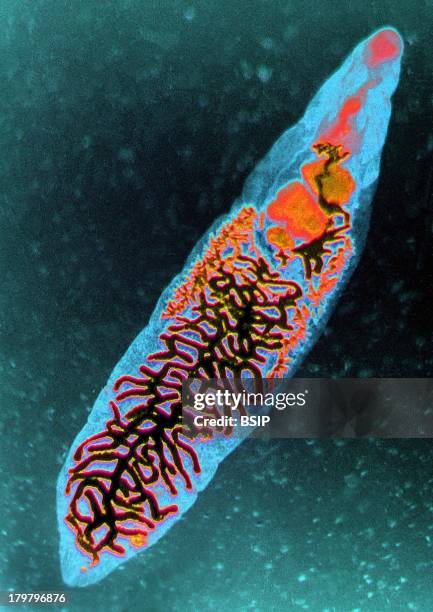 Intestinal Fluke, Parasitic, Hermaphroditic Flatworm, And The Causative Agent Of Distomatosis, Microscopic Image, 200X.