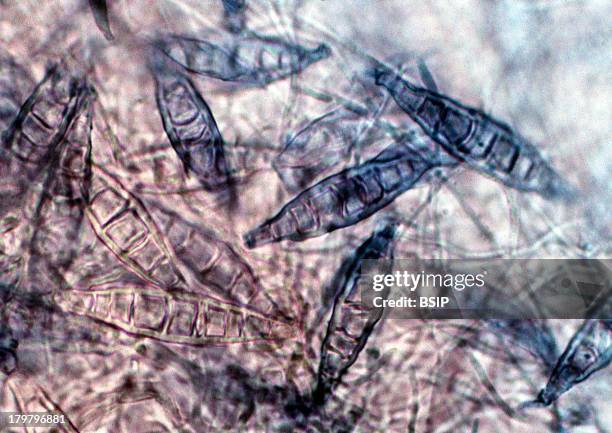 Microsporum, Fungus Which Is The Causative Agent Of Tinea, Ringworm, Microscopic Image, 600X.