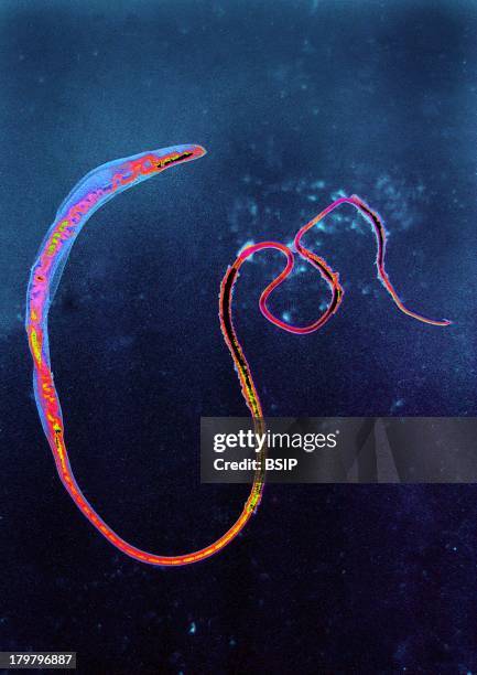 Trichocephalus, Parasitic, Egg-Laying, Hematophagous, Intestinal Worm And The Causative Agent Of Trichuriasis, Microscopic Image, 200X.