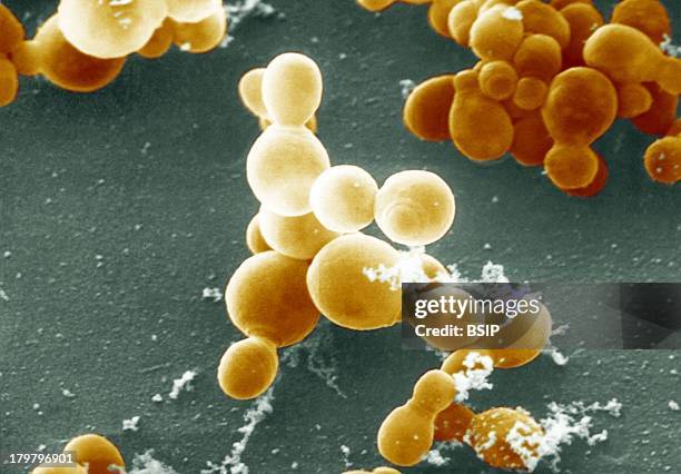 Malassezia Furfur, Scanning Electron Micrograph Of Malassezia Furfur, Formerly Known As Pityrosporum Orbiculare, This Fungus Causes The Skin Disease...