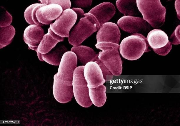 Malassezia, Sem, Seborrheic Dermatitis, Malassezia Pachydermatis Cause External Otitidis In The Dog, The Morphology Of Malassezia Yeasts Is Very...