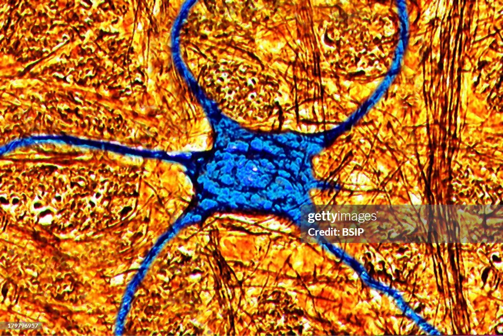 Human Neuron, Digital Light Microscope