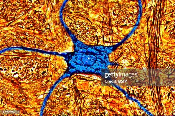 Human Neuron, Digital Light Microscope Human Neuron, Digital Light Microscope