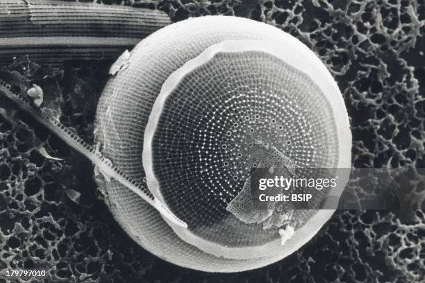 Diatom, Sem, Centric Diatom, Melosira Valve, Sem 3200X.