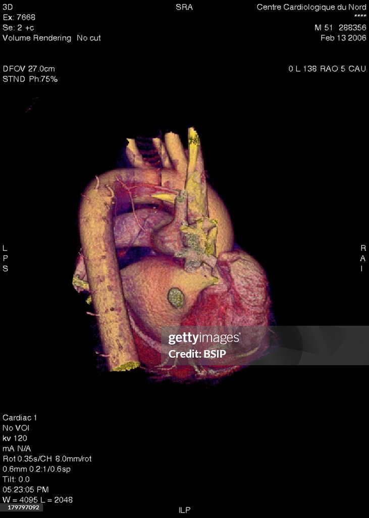 Heart, 3D Scan