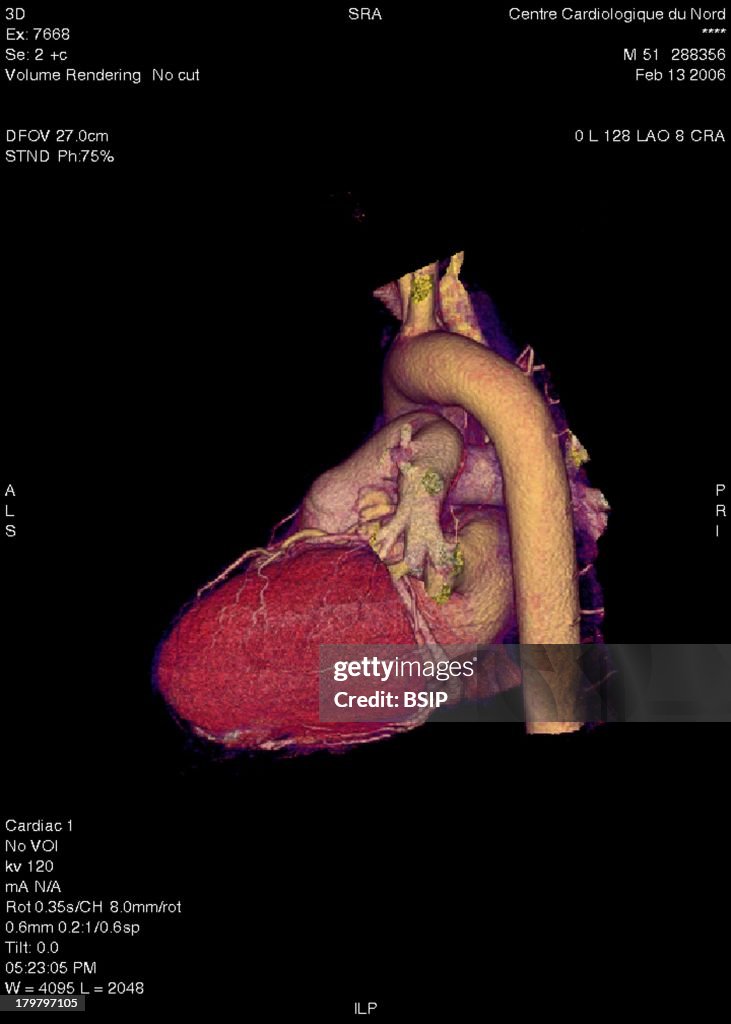 Heart, 3D Scan