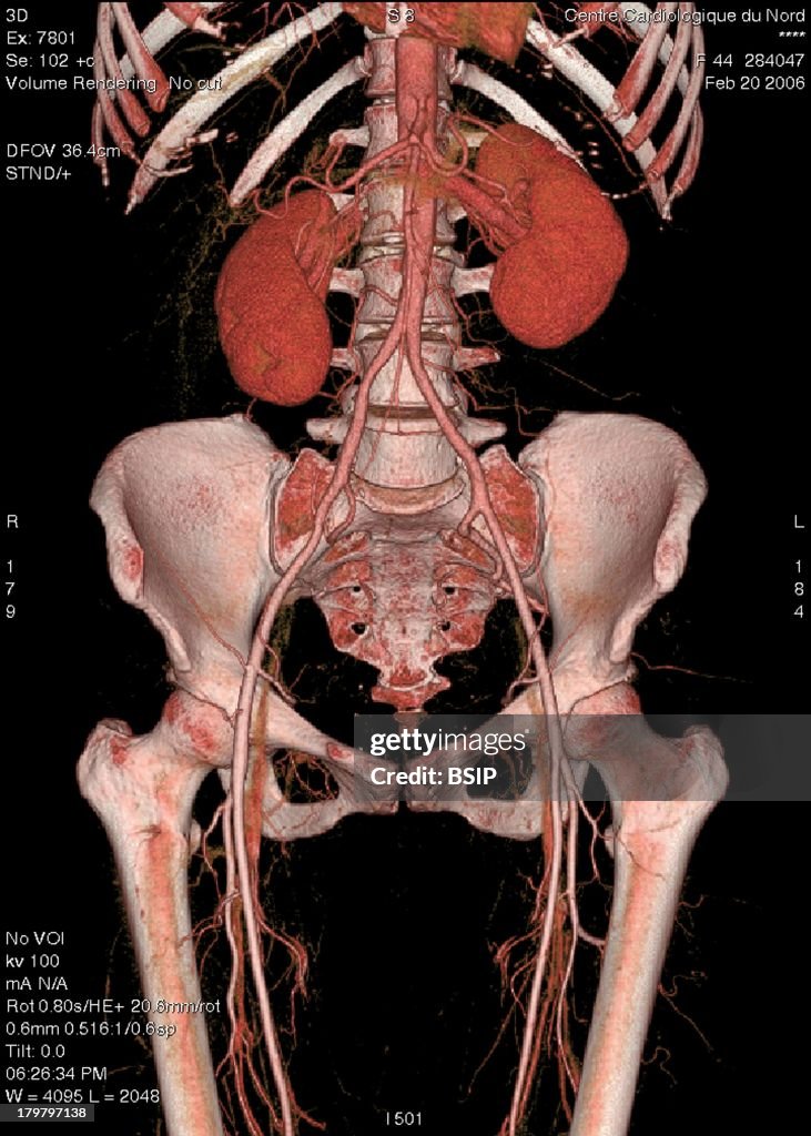 Blood Circulation, 3D Scan