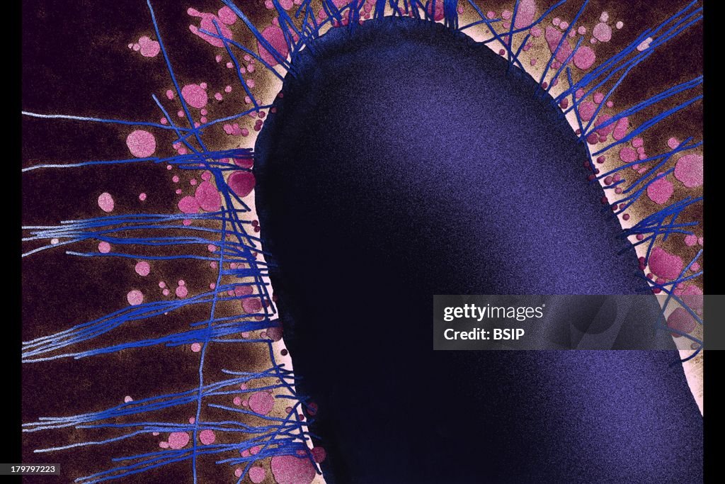 Escherichia Coli
