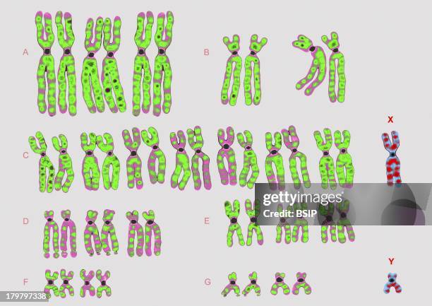 Development Denver Classification Human Karyotypes Photos and Premium High Res Pictures - Getty Images