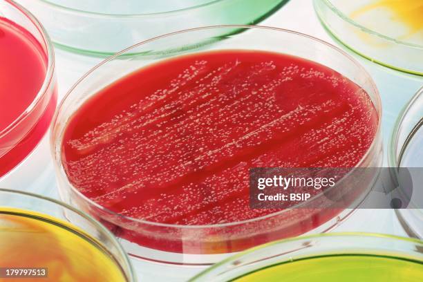 Streptococcus B.