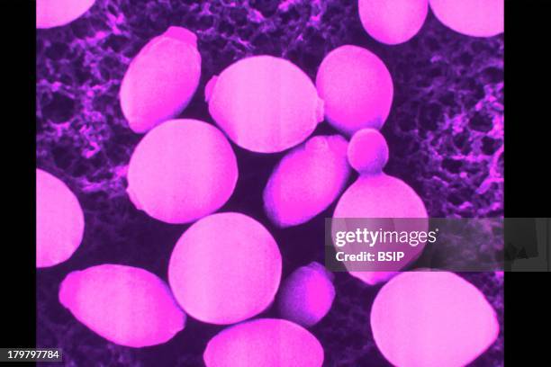 47 Cryptococcus Neoformans Stock Photos, High-Res Pictures, and Images ...