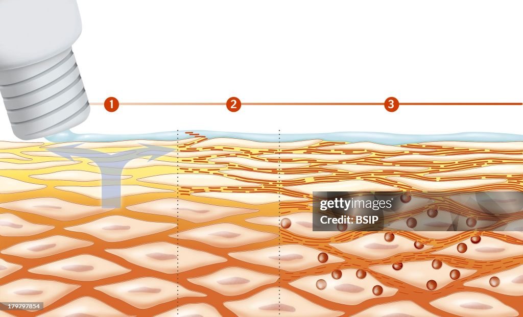 Skin Hydration, Illustration