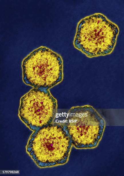 Hepatitis A Virus.