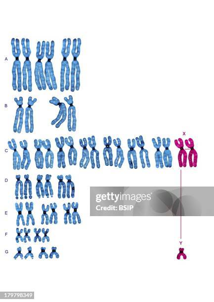 Development Denver Classification Human Karyotypes Photos and Premium High Res Pictures - Getty Images