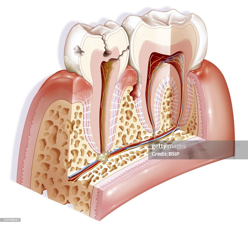 Dental Pathology, Drawing