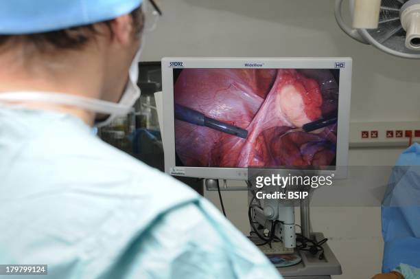 Lyon Hospital, Department of urology. Sex reassignment surgery, transgender Female to Male, hystero-ovariectomy under laparoscopy. Operation which...