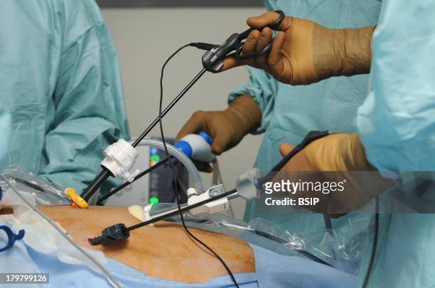 Surgery, Coelioscopy, Lyon Hospital, Department of urology. Sex reassignment surgery, transgender Female to Male, hystero-ovariectomy under...