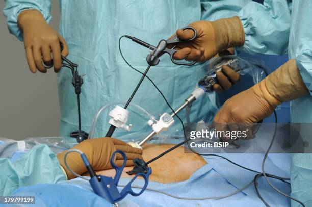 46 Coelioscopy Photos and Premium High Res Pictures - Getty Images