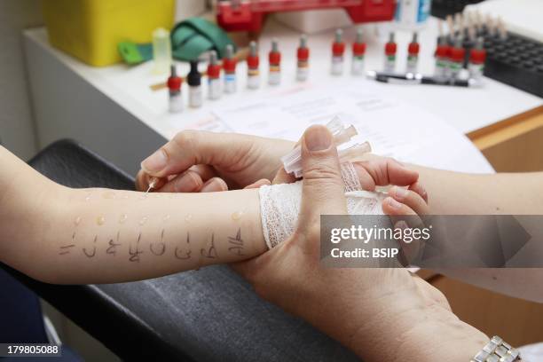 Allergology department of Saint-Vincent de Paul hospital, GHICL, Lille. Food Allergies, Prick test using reference allergens, on a boy's skin.