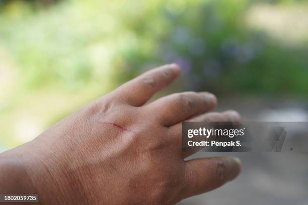 Back Scarification 1,641 Scarification Stock Photos, High-Res Pictures, and Images - Getty ...