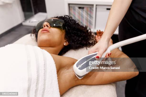 close up of a female hand that does a laser treatment for hair removal to a young woman with protective glasses - laser stockfoto's en -beelden
