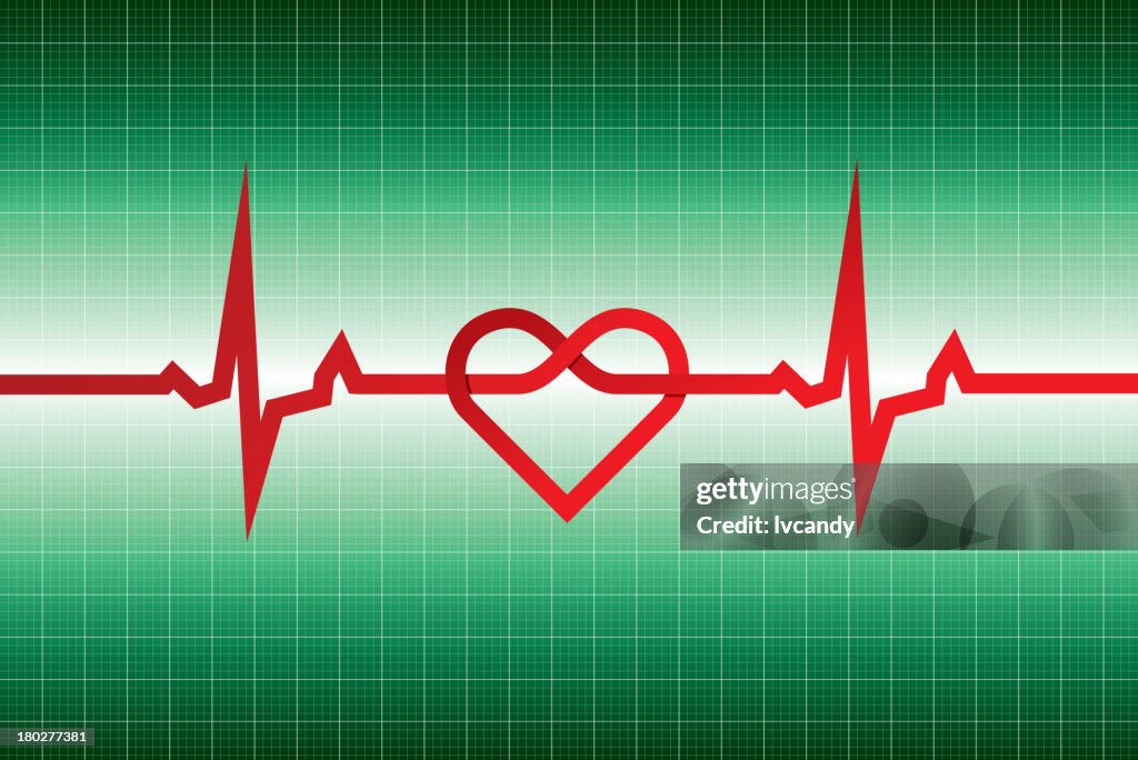 Electrocardiogram