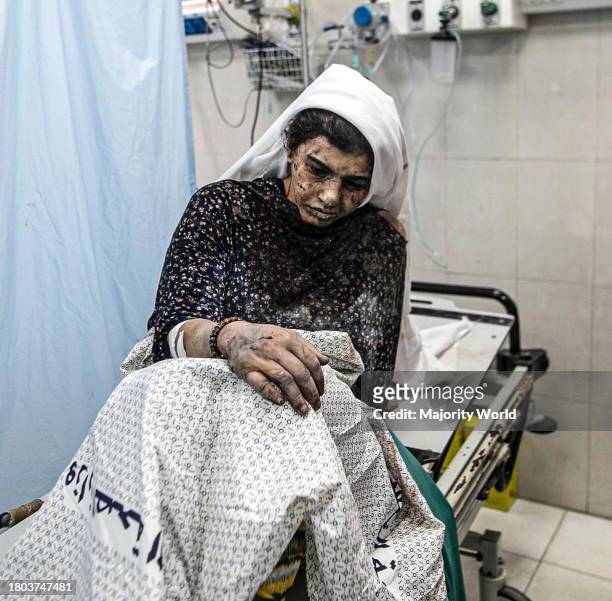 An injured Palestinian woman in Nasser Hospital after her family home was bombed in Khan Yunis, south of the Gaza Strip. Palestine.