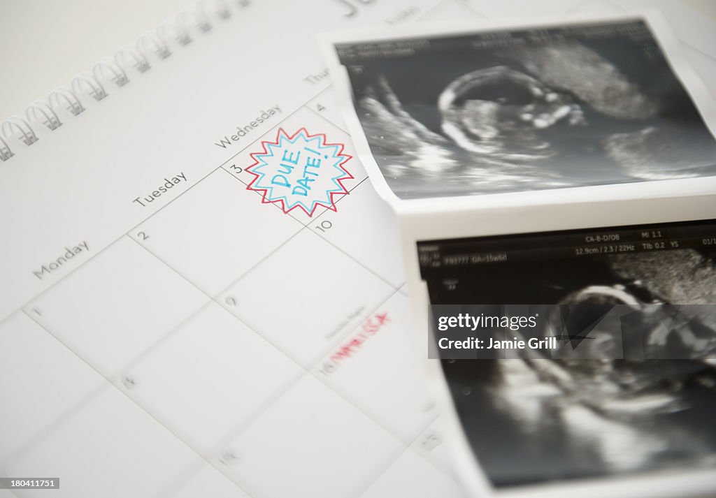 Studio Shot of ultrasound picture lying on calendar