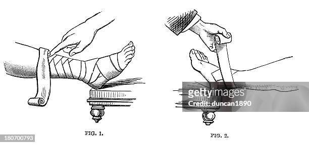 foot bandage - ankle sprain stock illustrations