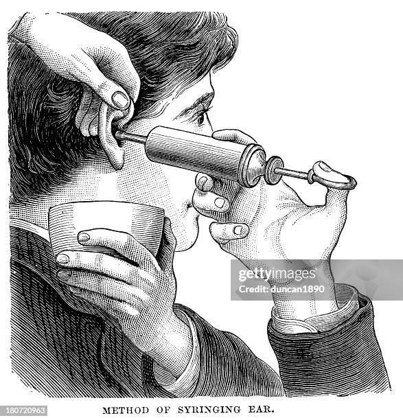 method of syringing the ear - cleaning ears stock illustrations
