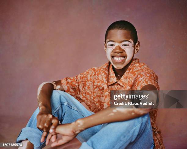 cheerful boy with skin vitiligo - blank black shirt stock pictures, royalty-free photos & images