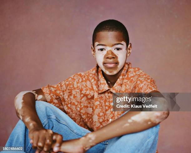 smiling boy with vitiligo wearing floral shirt - face arms stock pictures, royalty-free photos & images