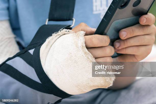 arm broken - cast on the hand of a child holding a mobile phone close-up - vetroresina foto e immagini stock