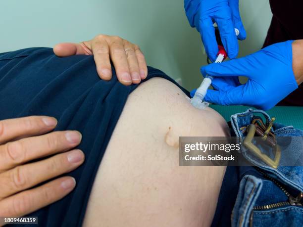 receiving prostate cancer treatment - hormone therapy stock pictures, royalty-free photos & images