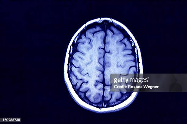 brain scan - magnetresonanztomographie stock-fotos und bilder