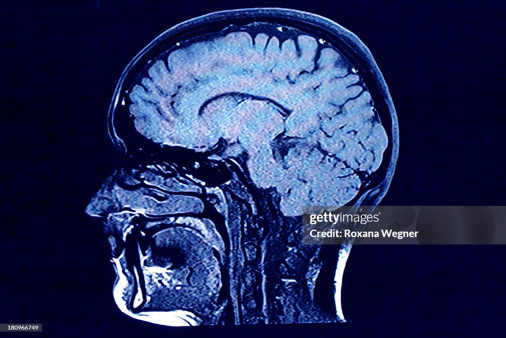 Brain head scan