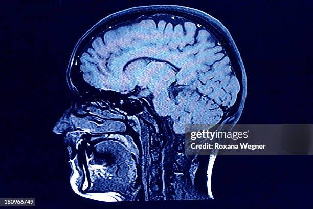 brain head scan - scansione medica foto e immagini stock