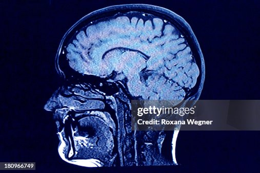 Brain head scan Brain head scan