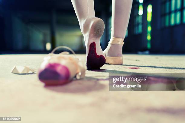 wounded young ballet dancer walking away with injured foot - ballet feet hurt stock pictures, royalty-free photos & images