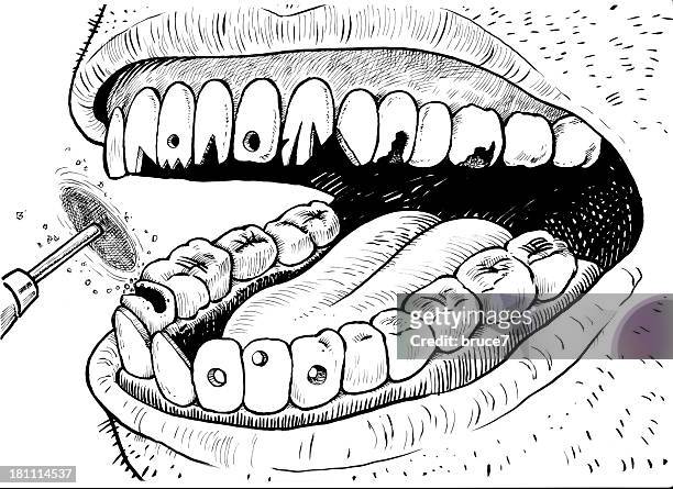 diy dentitry - rotten teeth from not brushing 幅插畫檔、美工圖案、卡通及圖標