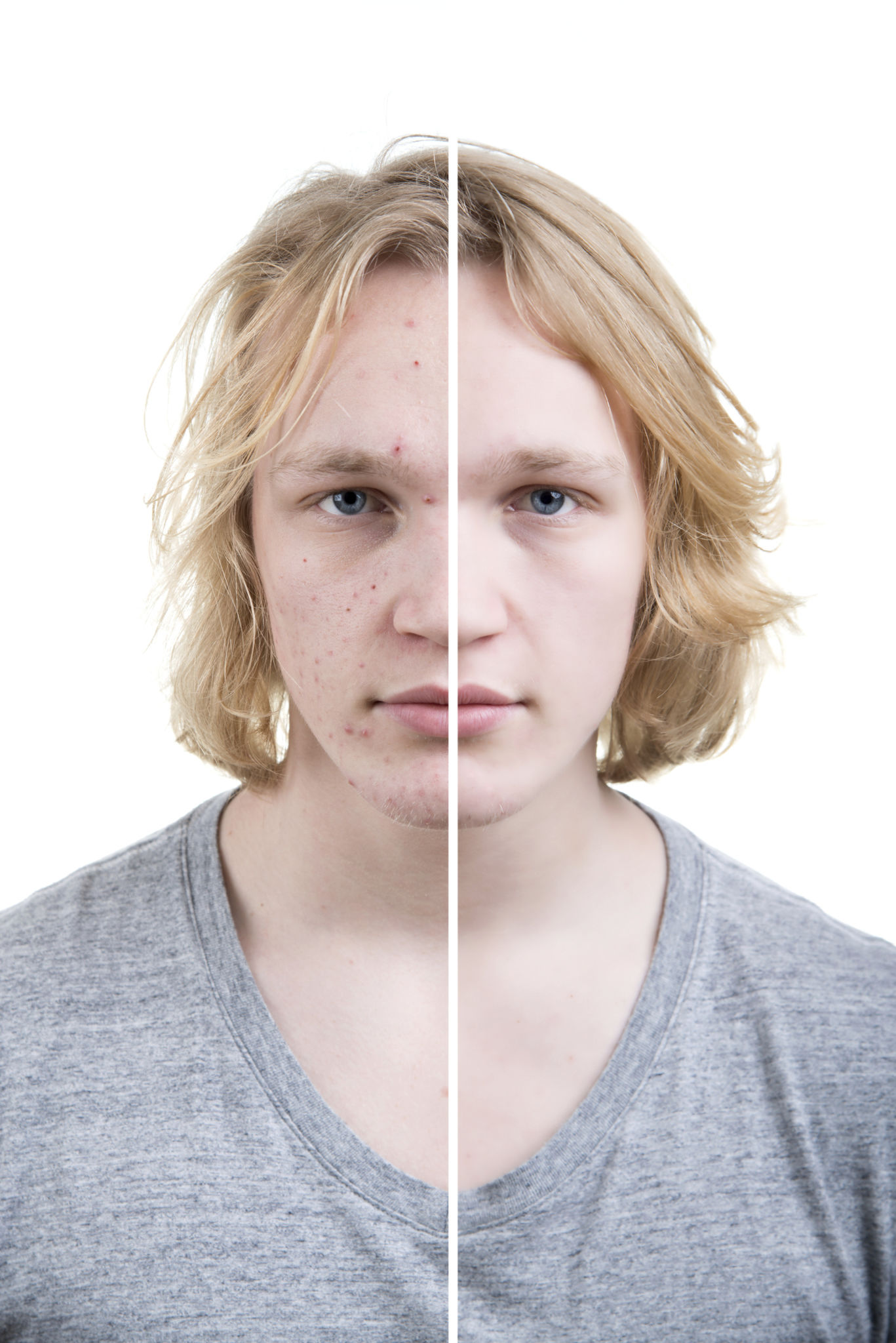 Before and after retouch Before and after retouch