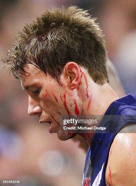 Lee Spurr of the Dockers comes off with blood on his face during the AFL Second Preliminary Final match between the Fremantle Dockers and the Sydney...