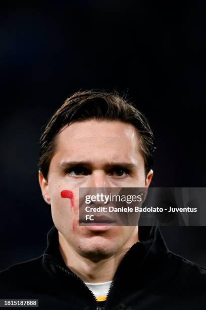 Federico Chiesa of Juventus with a red mark on his face for the campaign against violence on women, looks on prior to the Serie A TIM match between...