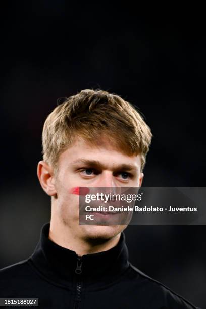 Hans Nicolussi Caviglia of Juventus with a red mark on his face for the campaign against violence on women, looks on prior to during the Serie A TIM...