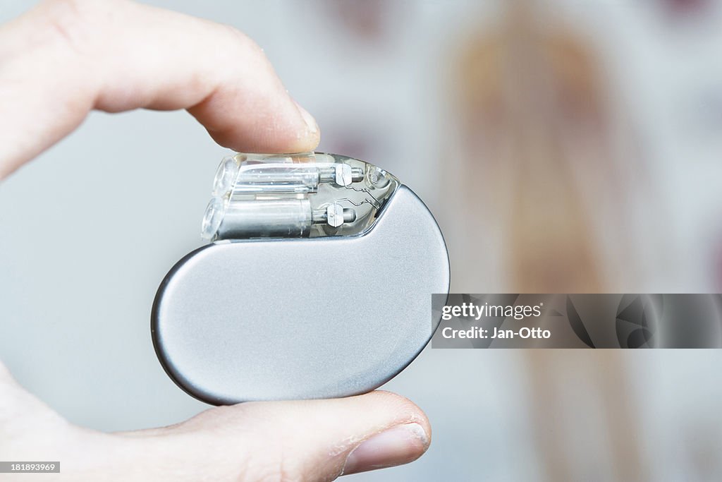 Gi Pacemaker Cardiac Pacemaker High-Res Stock Photo - Getty Images