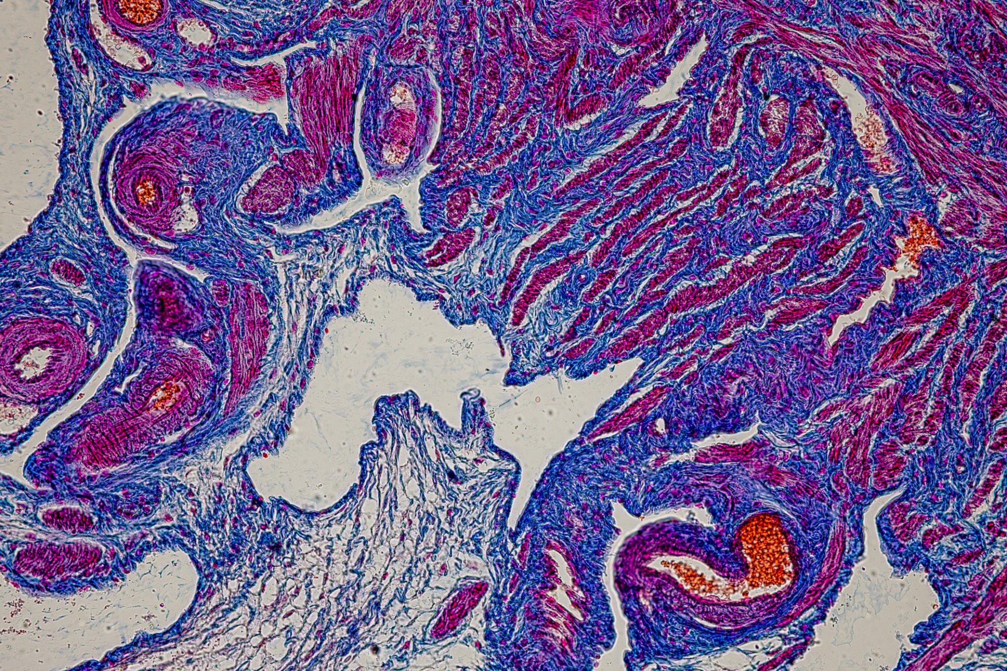 Adipose tissue human, Smooth muscles human, Bone human and Striated (skeletal) muscle human under the microscope in Lab. Adipose tissue human, Smooth muscles human, Bone human and Striated (skeletal) muscle human under the microscope in Lab.